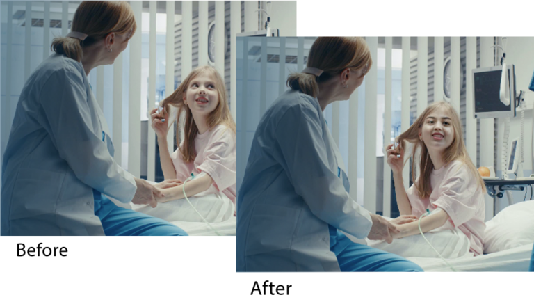 Two images side by side of a nurse with a patient. The first is the original, the second shows the patient's face modified by the Smart Anonymization facial protection.